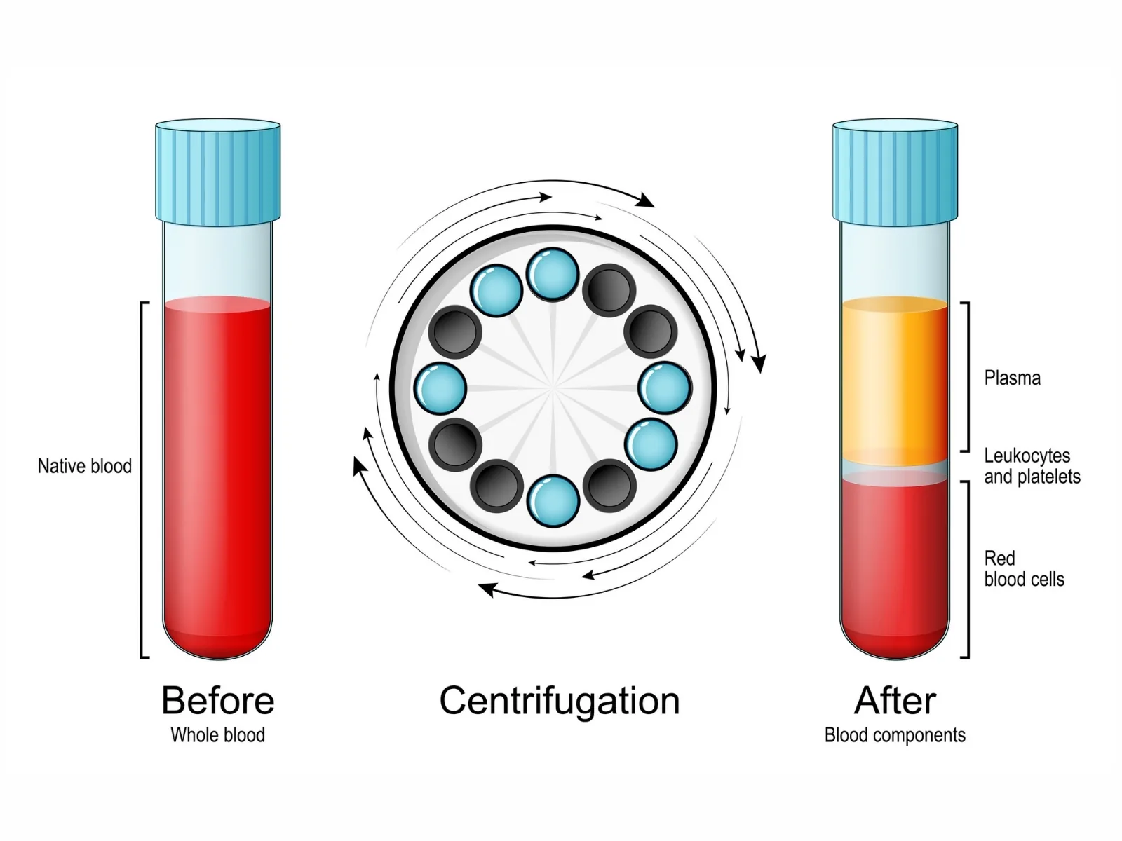 PRP (Platelet Rich Plasma) PRP (Platelet Rich Plasma)